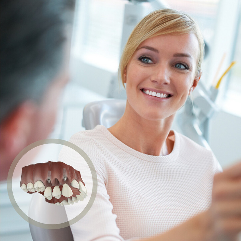 Implant bridge replacing several missing teeth in Guildford