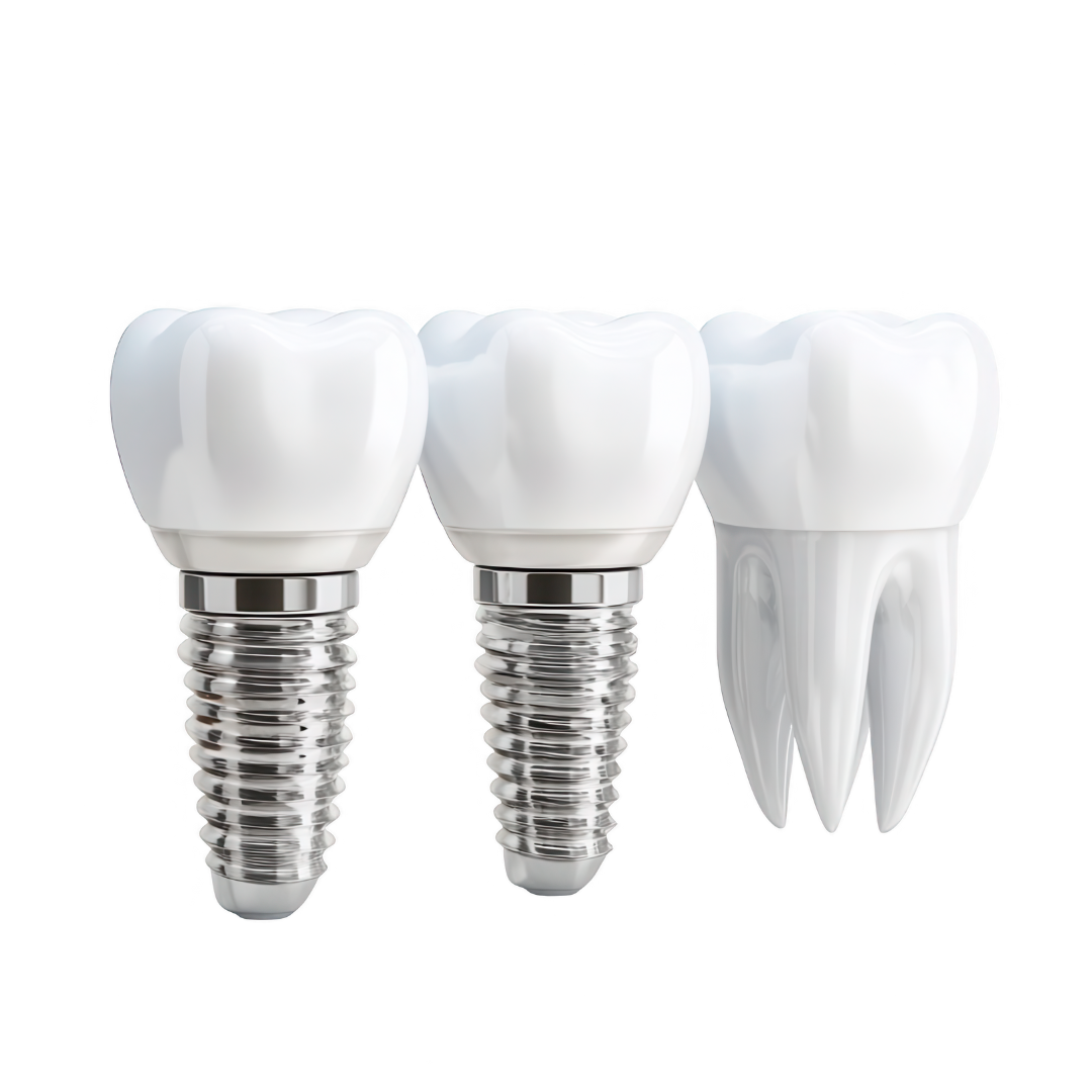 Dental implant models showing implant posts and crowns