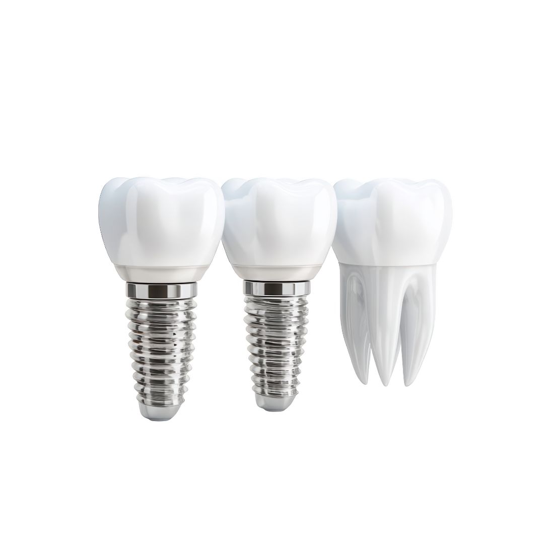 dental implants Guildford