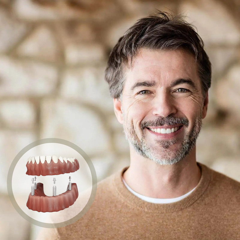Implant retained dentures at our Guildford implant clinic